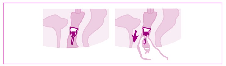 Schéma insertion coupe menstruelle, protection
